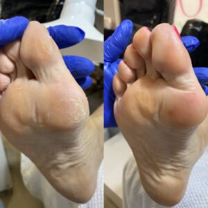 Curso pedicura estetica